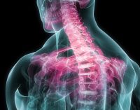 Top 3 Factors to Seek Chiropractic Care