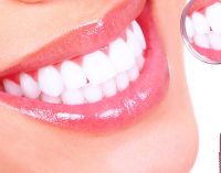 How to whiten your teeth through Idol White Teeth Whitening Pen