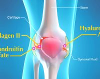 How to get relief from Joint Pain