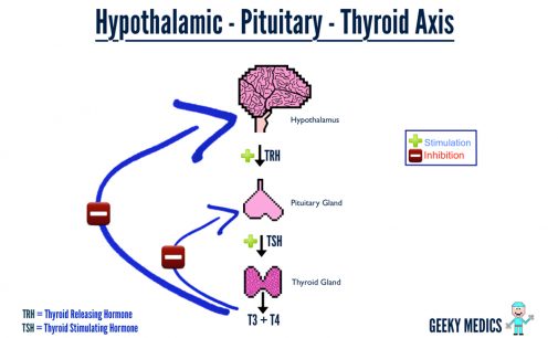 Top 7 advices for Hypothyroidism Patients