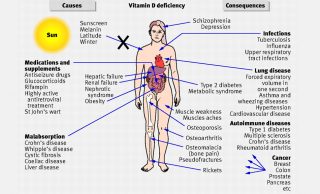 Top 7 Points -Why You Need Vitamin D