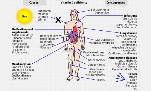 Top 7 Points -Why You Need Vitamin D